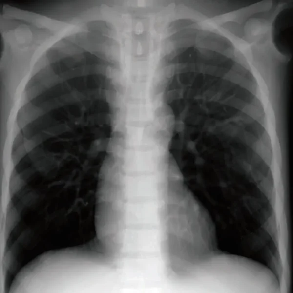 فانتوم تمام تنه رادیوگرافی بزرگسال