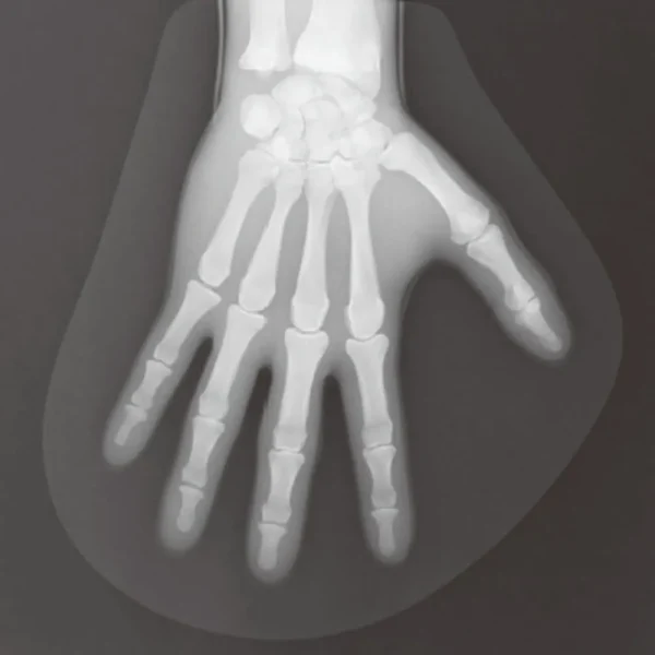 فانتوم تمام تنه رادیوگرافی بزرگسال