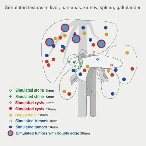 فانتوم نیم تنه سونوگرافی