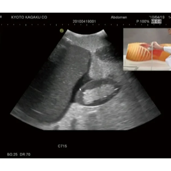 فانتوم نیم تنه سونوگرافی شکم