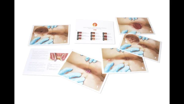 مانکن معاینات رکتال و پروستات