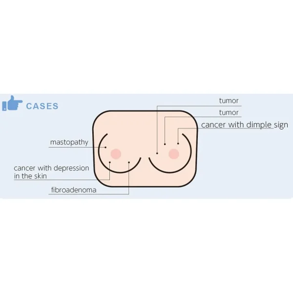 مانکن معاینات پستان