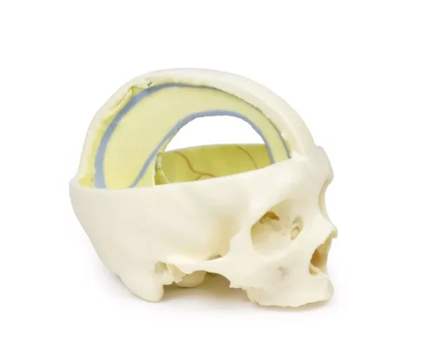 مولاژ نمایش سه بعدی جمجمه