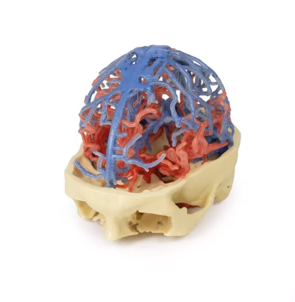 مولاژ نمایش سه بعدی گردش خون عروق مغزی
