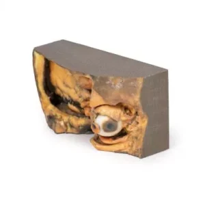 مولاژ نمایش سه بعدی حدقه چشم (Lateral)