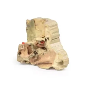 مولاژ نمایش سه بعدی حدقه چشم (Medial)