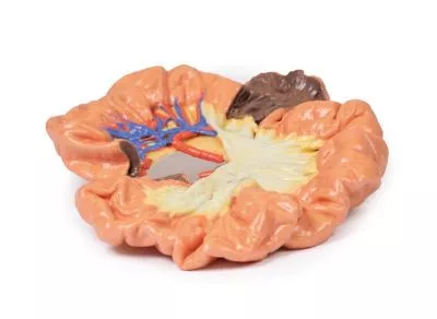 مولاژ نمایش سه بعدی روده و ایلئوم