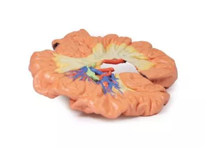 مولاژ نمایش سه بعدی روده و ایلئوم