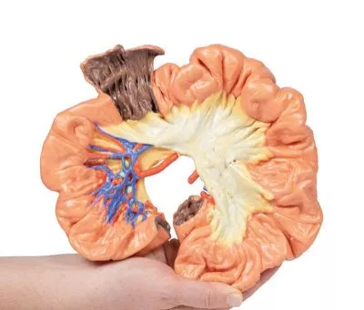 مولاژ نمایش سه بعدی روده و ایلئوم