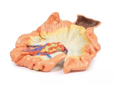 مولاژ نمایش سه بعدی روده و ژئوژنوم