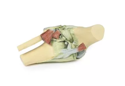 مولاژ نمایش سه بعدی زانو (Flexed)