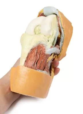 مولاژ نمایش سه بعدی مفصل زانو