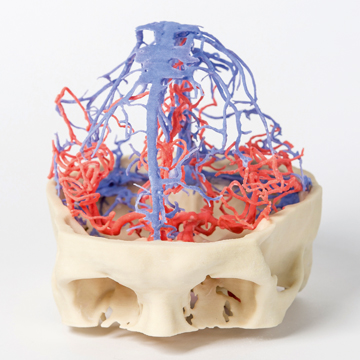مولاژ نمایش سه بعدی گردش خون عروق مغزی