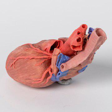 مولاژ نمایش سه بعدی قلب و تراکیا