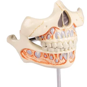 مولاژ دندان شیری